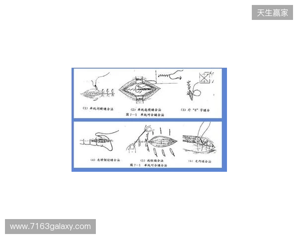 广州豹官方:杨浩眉弓伤口缝合30余针,预计5-7天后拆线 广州豹官方:杨浩眉弓伤口缝合30余针,预计5-7天后拆线